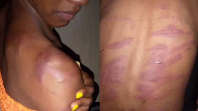 Young woman shows wounds her mother inflicted on her because she went to make her hair